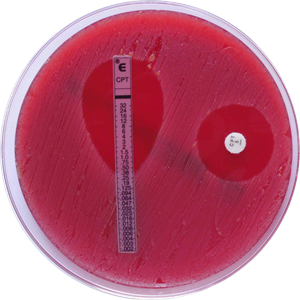 horova_clanek_antiinfektiva